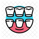 Veneers Dental Procedure Icon