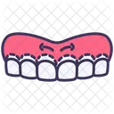 Zahnfleischoperation  Symbol
