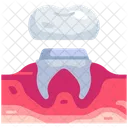 Zahnkrone  Symbol