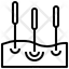 acupuntura