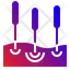 acupuntura