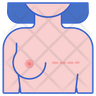 free mastectomy icons