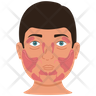 sjogrens syndrome icon png