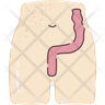icon rectum
