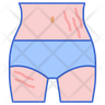 icons for stretch mark