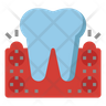 periodontal disease symbol