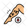 venous edema emoji